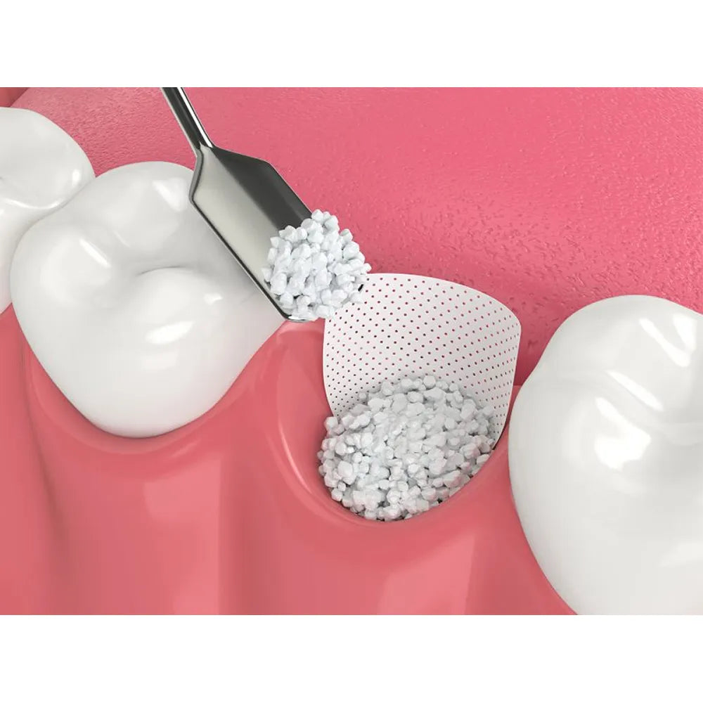 Bone Collector Scoop DLC Coating (Small-Wide Scoop and Large-Narrow Scoop Tip) #BCS