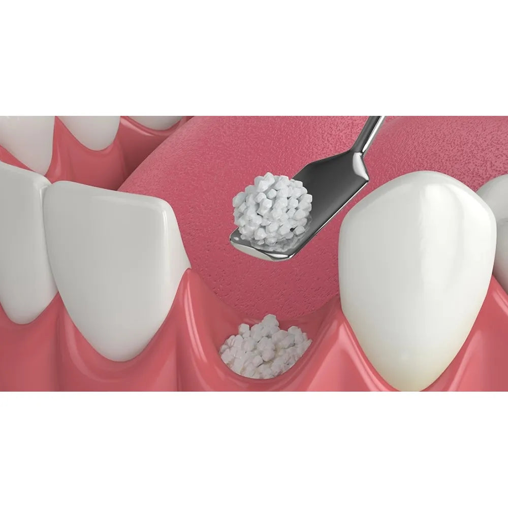 Bone Collector Scoop DLC Coating (Small-Wide Scoop and Large-Narrow Scoop Tip) #BCS